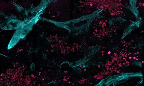 Non-invasive imaging method spots cancer at the molecular level